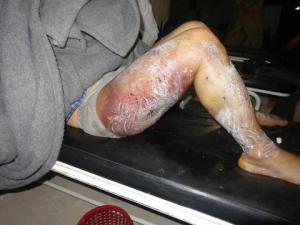 Tortured by FSA
