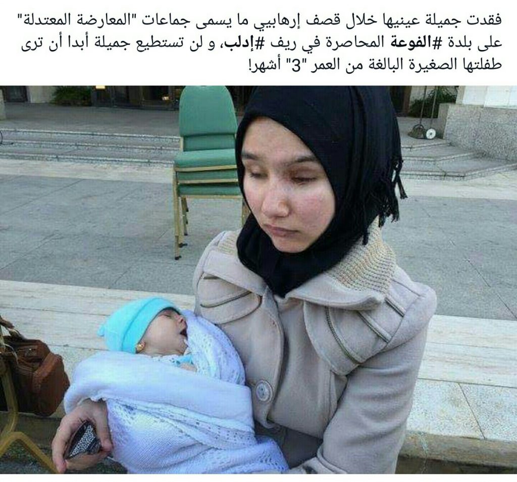 image-Lady lost sight due to terrorists shelling of Foua
