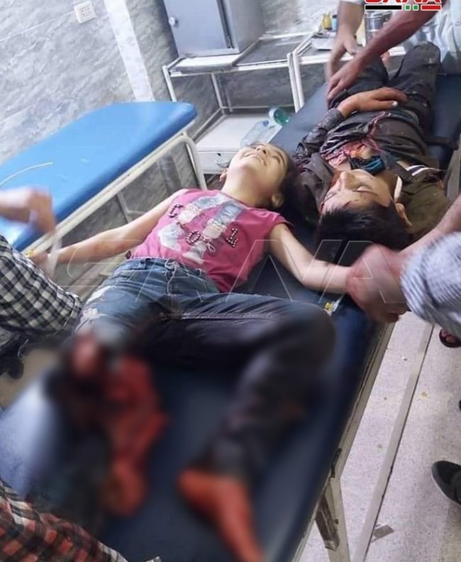 Syrian child injured by Erdogan forces bombing