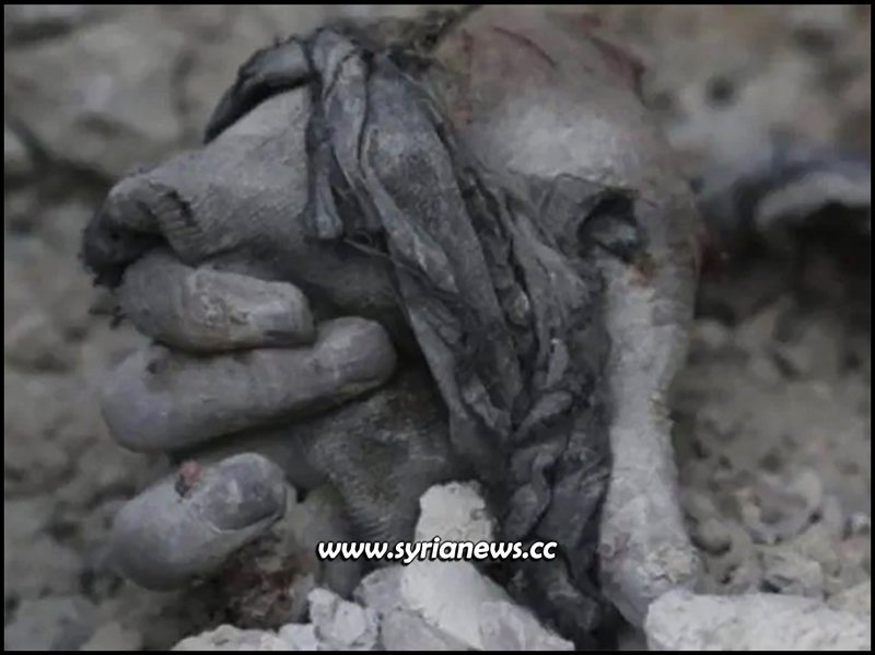 moulage prosthetic hollswood news about Syria
