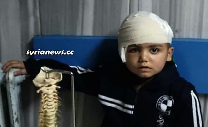 Surgery on Syrian child with Rasmussen's encephalitis
