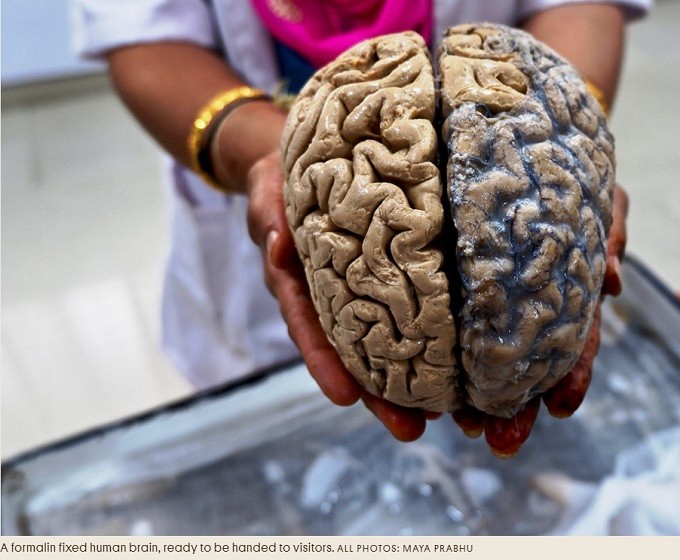 brain's two hemispheres