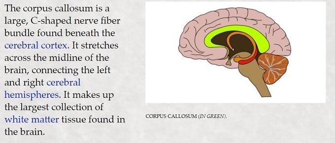 corpus callosum