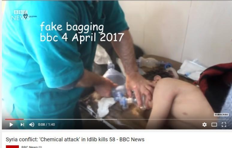 White Helmets can't bag.