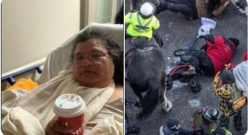 #BlackFaceHitler's gestapo's blindfolded horses stomped this elderly indigenous lady; no matter as he supports Nazis in Ukraine.