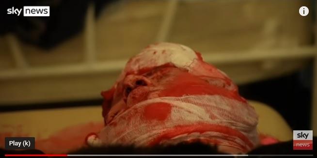 Never any type of emergency care. This allegedly in Mariupol hospital. Mariupol is not in Ukraine.