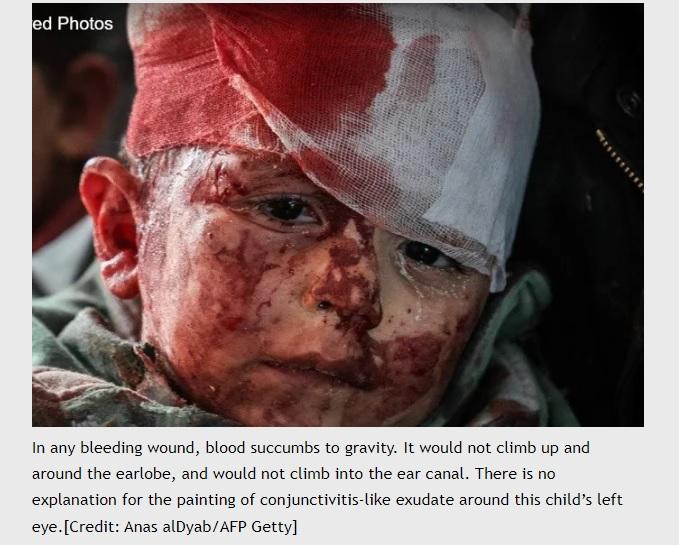 Grotesque trauma propaganda against Syria, now used against Russia, in Mariupol which is not part of Ukraine.