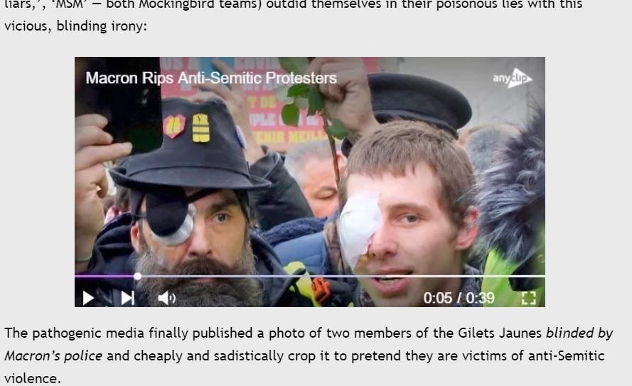 Vichy Macron inferred Gilets Jaunes he blinded were victims of anti-Semitism. Now he weeps for Ukraine Nazis.