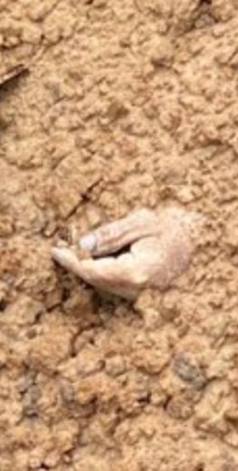 One of many photos of body parts sticking out of what appears to be a gravel pit, in Bucha Ukraine.